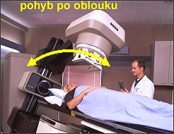 Radioterapie